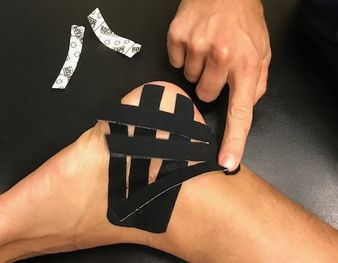 Kinesio Tape for Rolled Ankle